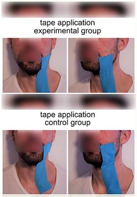 Shaping the Sensory–Motor Network by Short-Term Unresolvable Sensory–Motor Mismatch